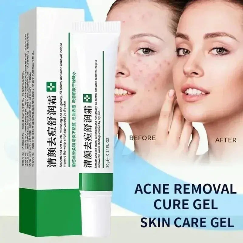 20g Whitening Freckle Cream Remove Dark Spot Cream Anti Freckle and Aging Cream Fade Pigmentation Melasma Brighten Serum Skin