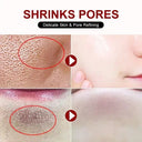 Pore Tightening Cream for Large Pores
