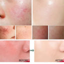 Facial Redness Repair Cream For Sensitive Skin Rosacea Hydrating Day Night