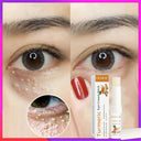 Firming Eye Roll On For Puffiness Now
