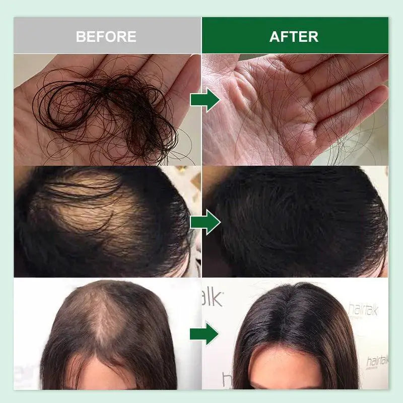 Rosemary Oil Hair Growth Elixir For Thicker Stronger Hair