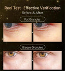 Firming Eye Roll On For Puffiness Now