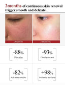 Pore Tightening Cream for Large Pores