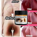 Brightening Body Cream for Private Areas