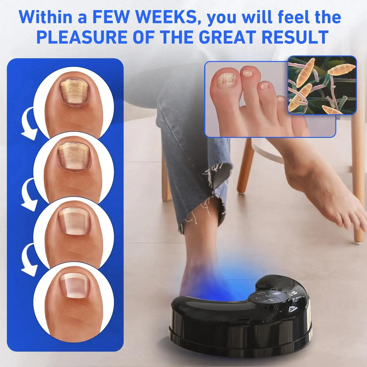 Wireless Nail Fungus Cleaning Device for Toenails & Fingernails — product view 5