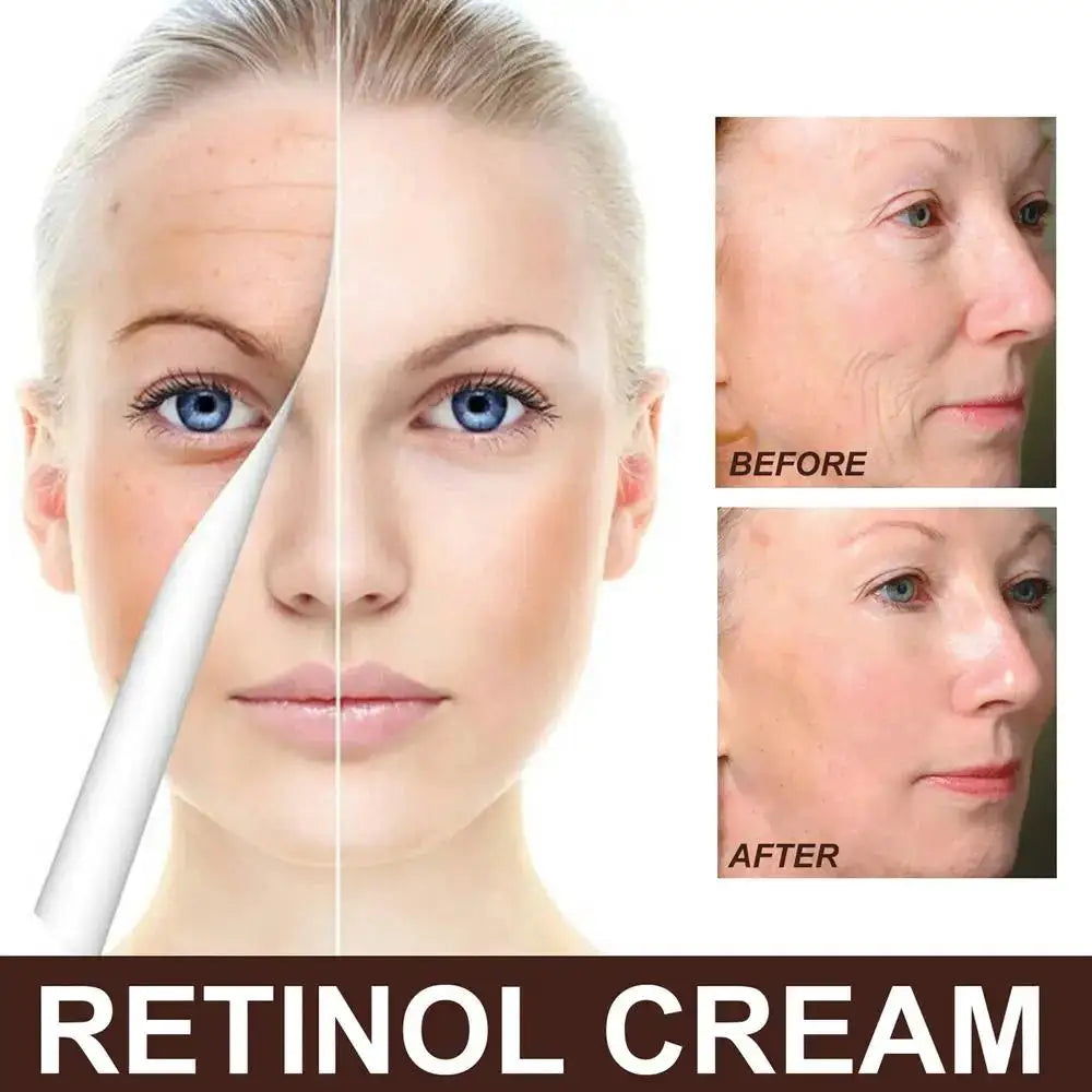 Retinol Face Cream For Wrinkles Anti Aging Lift Night Cream — product view 8