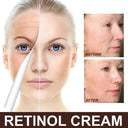 Smart Retinol Face Cream For Wrinkles Instant Lift Night