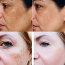 Face Cream for All Skin Brightens Tone