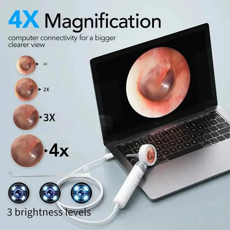 Smart Ear Camera Endoscope 90 Degree Rotatable Head With 1080P HD View 12 Heads - stepyours.com