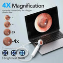 Smart Ear Endoscope for Home Health Checks at Home