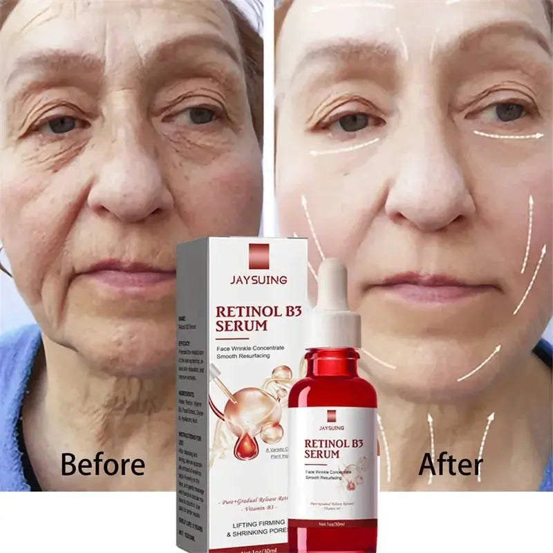 Retinol Wrinkle Remover Face Serum Instant Firming Lifting