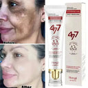 Brightening Melasma Cream for All Skin