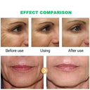 TRSTAY Anti Aging Eye And Facial Firming Moisturizing Whitening Cream Skin Care