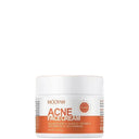 Oil Control Acne Cream for Clear Skin