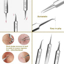 Acne Tweezers For Clear Skin At Home
