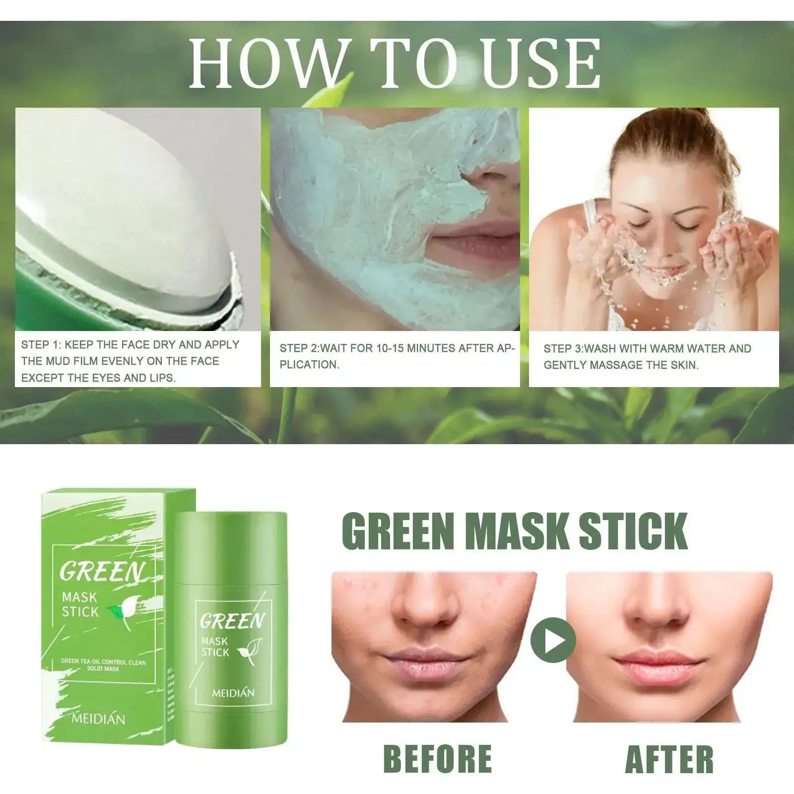 Acne Mask for Acne Prone Skin Pore Care
