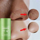 Acne Mask for Acne Prone Skin Pore Care