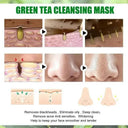 Acne Mask for Acne Prone Skin Pore Care
