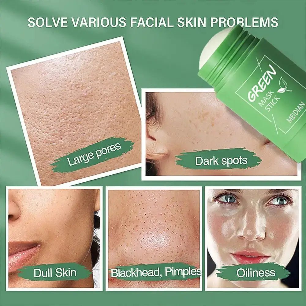 Acne Mask for Acne Prone Skin Pore Care