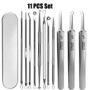 Advanced Blackhead Removal Set With Precision Tweezers Kit