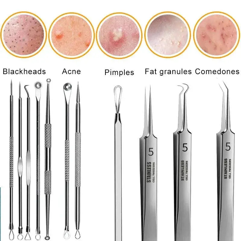 Advanced Blackhead Removal Tool Set with Precision Tweezers - OurLum.com
