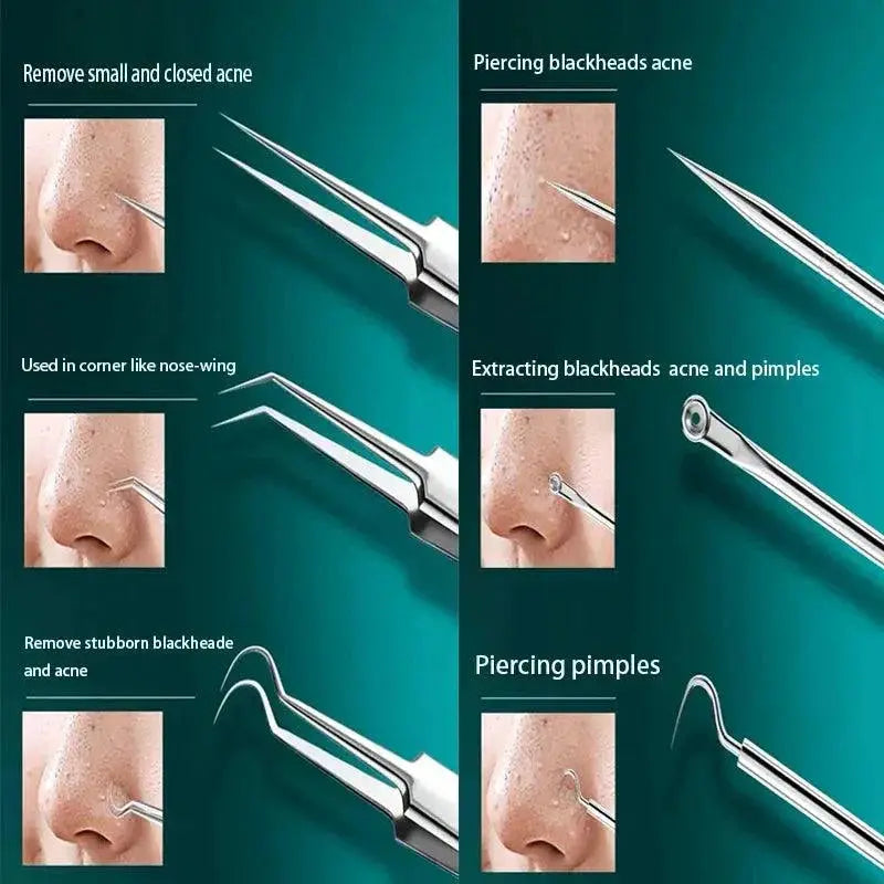 Advanced Blackhead Removal Tool Set with Precision Tweezers - OurLum.com