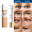 Anti Aging Eye Cream for Dark Circles