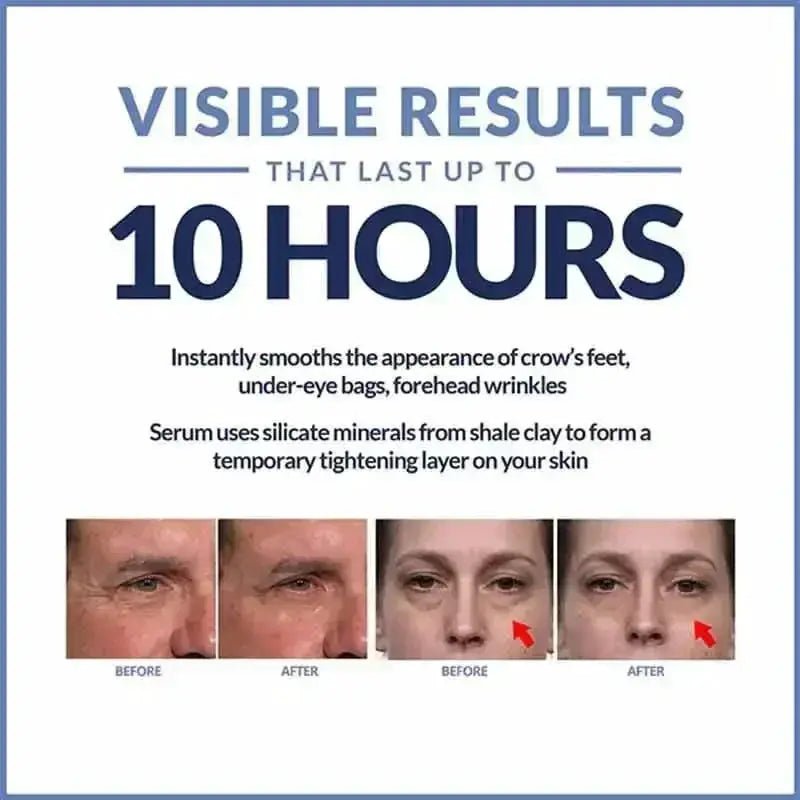 Anti Aging Eye Cream for Dark Circles