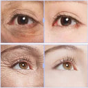 Anti Aging Eye Cream for Dark Circles