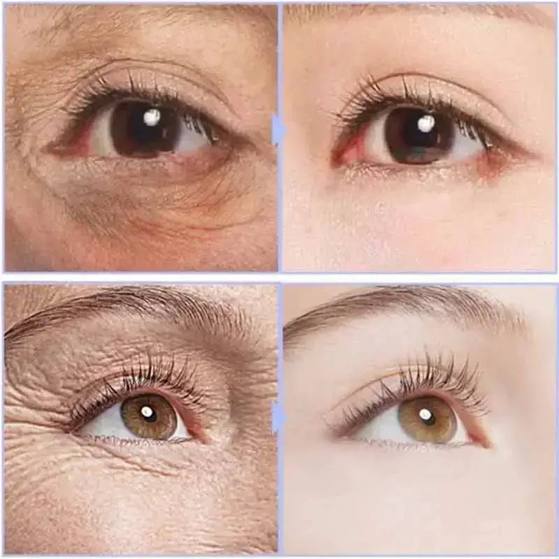 Anti Aging Eye Cream for Dark Circles — product view 13