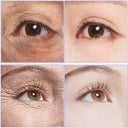 Anti Aging Eye Cream for Dark Circles