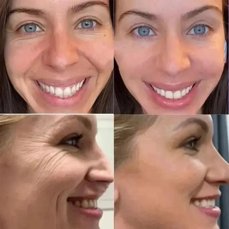 Anti-Wrinkle Balm For On-The-Go