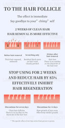 At-Home Laser Epilator for Silky Skin