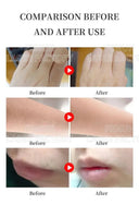 At-Home Laser Epilator for Silky Skin