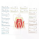 Precise Dental Scaler Tip for Hygienists
