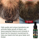Beard Growth Oil: Herbal Extracts for Nourished Care