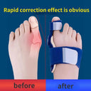 Big Toe Bunion Splint Set: Correct Foot Alignment Relieve Pain