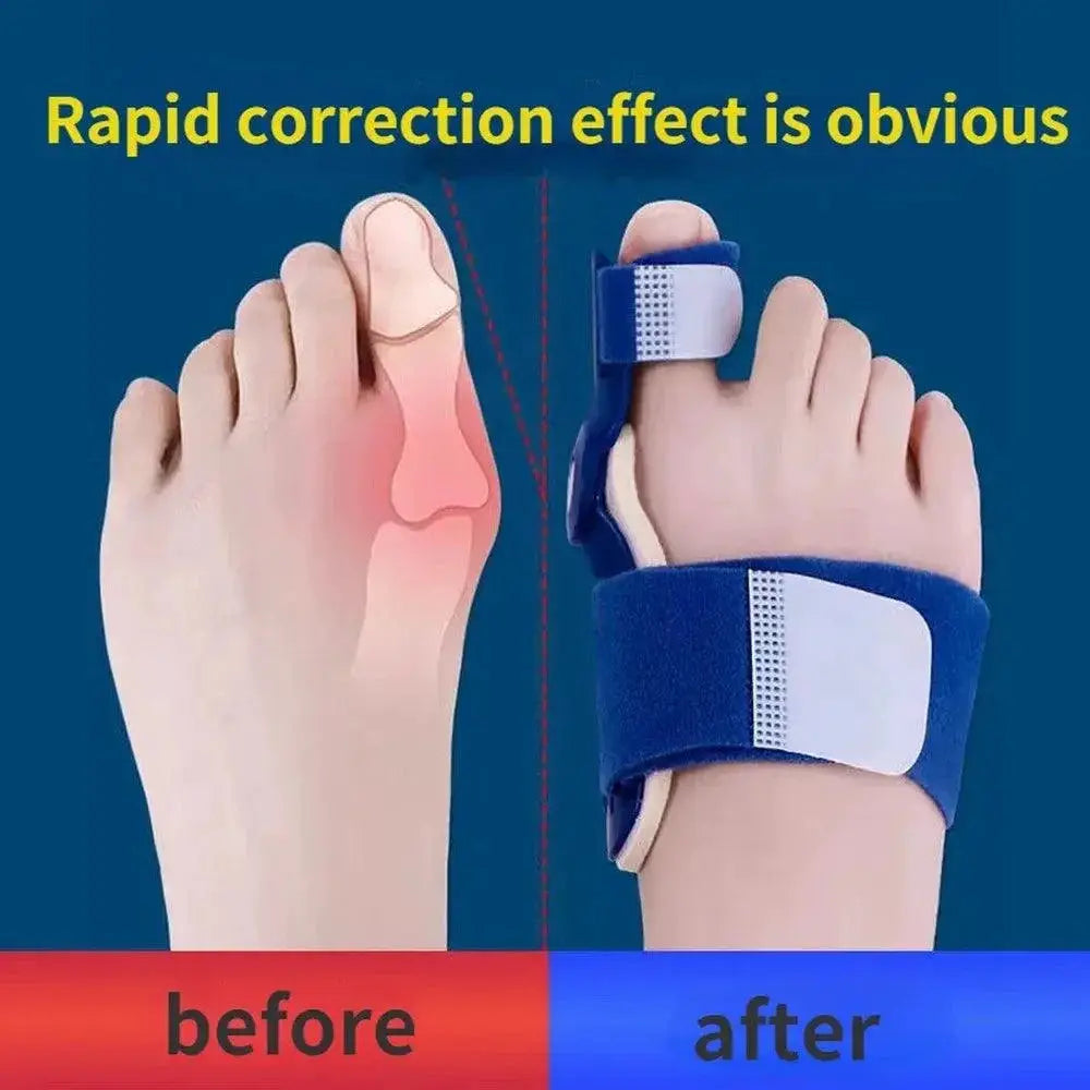 Bunion Splint Set For Foot Alignment Pain Relief Comfort