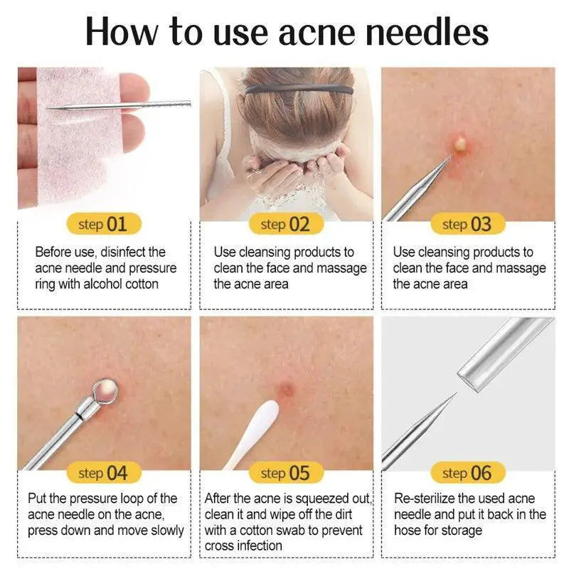 Blackhead Removal Kit Ultimate Solution For Flawless Skin