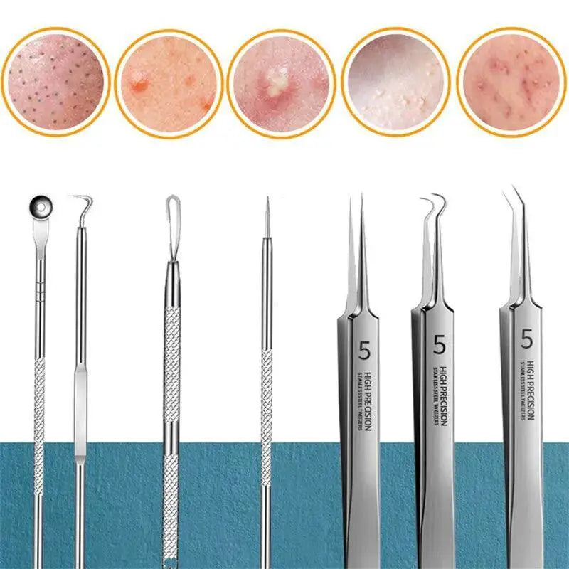 Blackhead Removal Kit Ultimate Solution For Flawless Skin