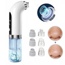 Blackhead Vacuum Pore Cleaner: Powerful Skin Purifier