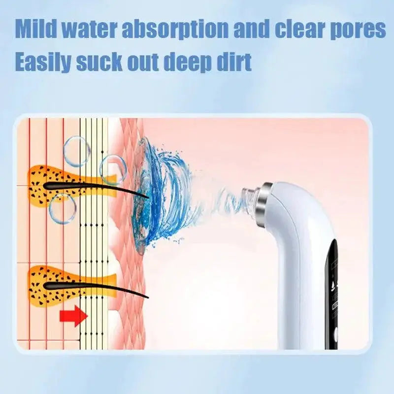 Blackhead Vacuum Pore Cleaner Powerful Skin Purifier Pro