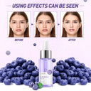 Blueberry Radiance Serum for Youthful Skin Glow 30ml