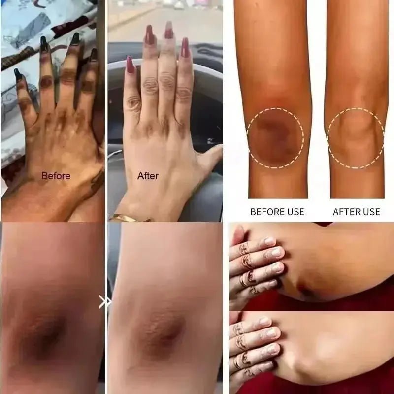 Body Whitening Lotion for Underarms