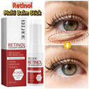Bright Eyes Eye Cream for Dark Circles