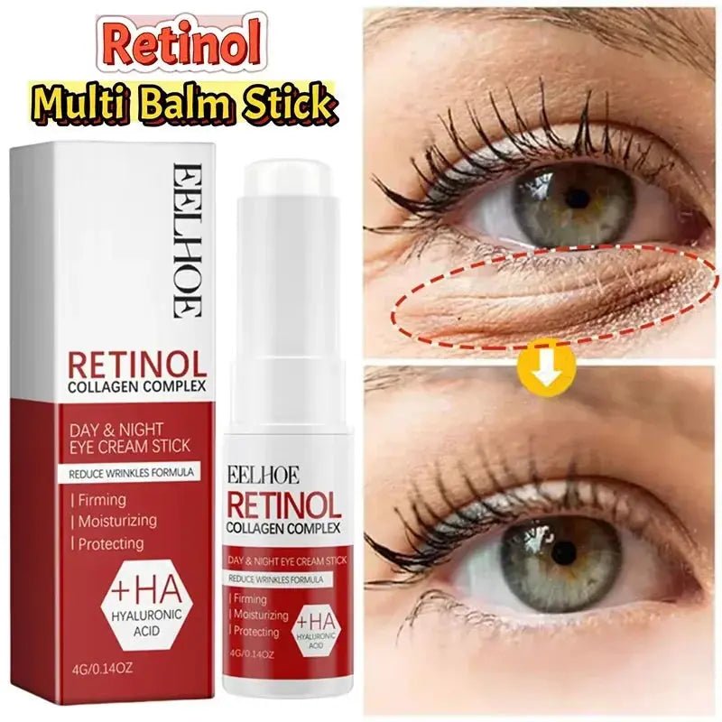 Bright Eyes Eye Cream for Dark Circles