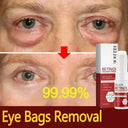 Bright Eyes Eye Cream for Dark Circles