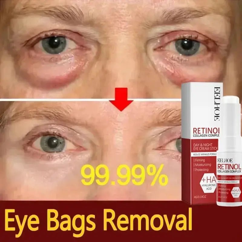 Bright Eyes Eye Cream for Dark Circles