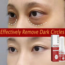 Bright Eyes Eye Cream for Dark Circles