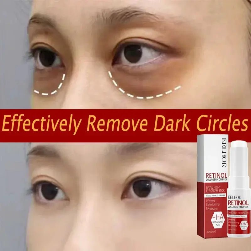 Bright Eyes Eye Cream for Dark Circles